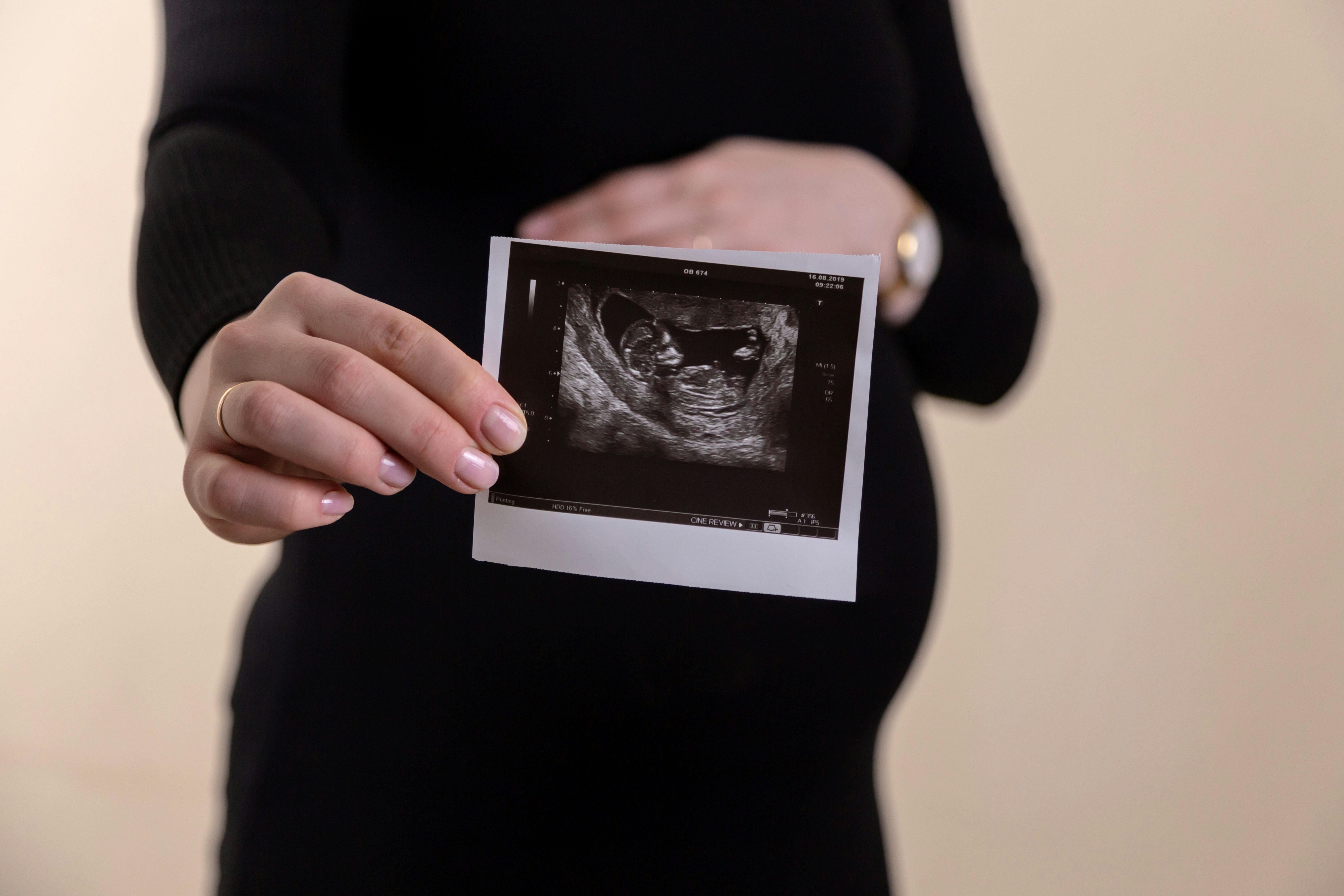 Pro-life organization mails postcards in Nebraska detailing fetal development ahead of election